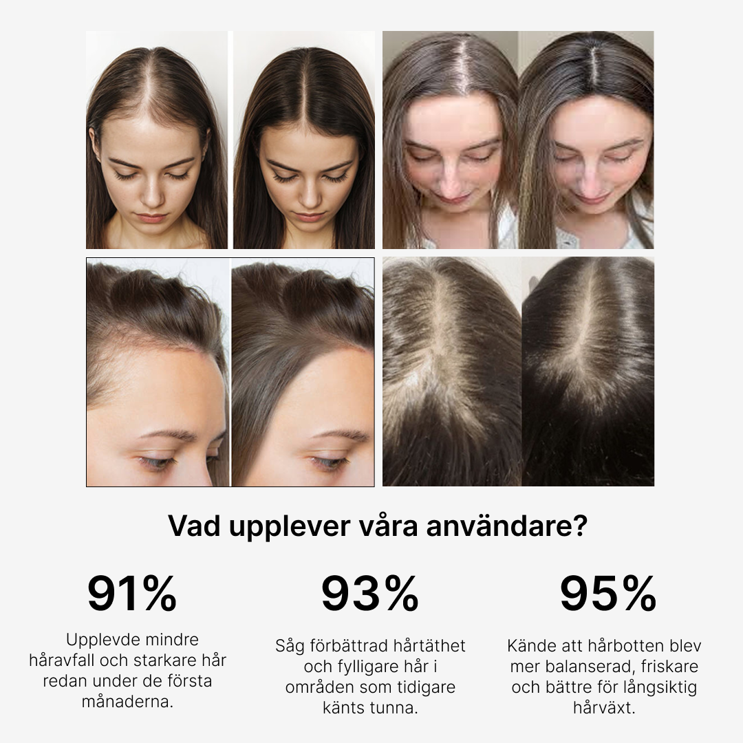 Hairroller - Från tunnare hår till synligt fylligare på 3 månader